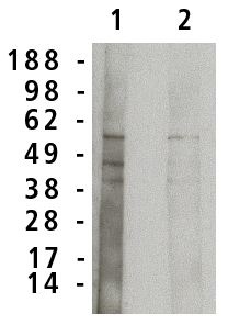 Western blot analysis using acid sphingomyelinase antibody on normal human brain lysate (7 µg/lane).  Antibody used at 1 µg/ml (1) and 0.5 µg/ml (2) and detected using mouse anti-rabbit antibody (Cat. No. X1207M) at 1:75k dilution and visualized using Pierce West Femto substrate.